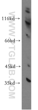 CCDC42 Antibody in Western Blot (WB)