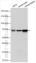 SLC22A24 Antibody in Western Blot (WB)