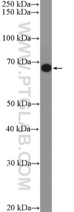 FAM171A2 Antibody in Western Blot (WB)