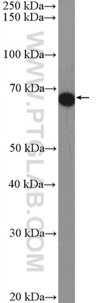 FAM171A2 Antibody in Western Blot (WB)