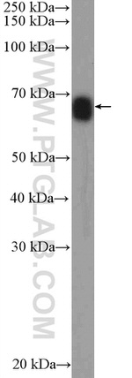 FAM171A2 Antibody in Western Blot (WB)