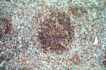 CXorf22 Antibody in Immunohistochemistry (Paraffin) (IHC (P))