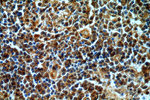 CXorf22 Antibody in Immunohistochemistry (Paraffin) (IHC (P))