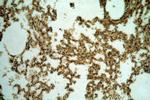 CXorf22 Antibody in Immunohistochemistry (Paraffin) (IHC (P))