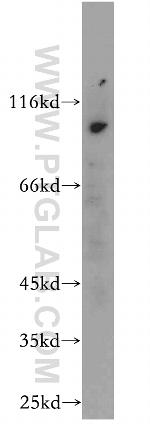 CXorf22 Antibody in Western Blot (WB)