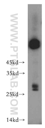 THAP2 Antibody in Western Blot (WB)