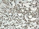 NSUN2 Antibody in Immunohistochemistry (Paraffin) (IHC (P))