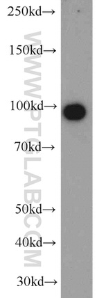 NSUN2 Antibody in Western Blot (WB)