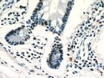 ZSCAN20 Antibody in Immunohistochemistry (Paraffin) (IHC (P))