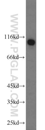 ZSCAN20 Antibody in Western Blot (WB)