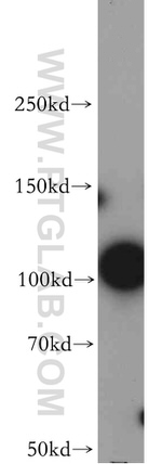ZSCAN20 Antibody in Western Blot (WB)