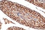 TCERG1L Antibody in Immunohistochemistry (Paraffin) (IHC (P))