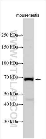 ZCWPW1 Antibody in Western Blot (WB)