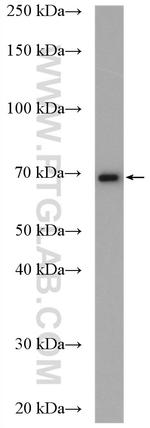 CALCR Antibody in Western Blot (WB)