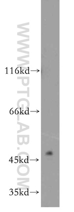 GABPB2 Antibody in Western Blot (WB)