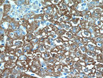 E-cadherin Antibody in Immunohistochemistry (Paraffin) (IHC (P))