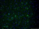 PKC epsilon Antibody in Immunohistochemistry (PFA fixed) (IHC (PFA))