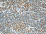 EPHB4 Antibody in Immunohistochemistry (Paraffin) (IHC (P))
