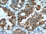 EPHB4 Antibody in Immunohistochemistry (Paraffin) (IHC (P))