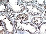 SDF2L1 Antibody in Immunohistochemistry (Paraffin) (IHC (P))