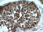 SDF2L1 Antibody in Immunohistochemistry (Paraffin) (IHC (P))