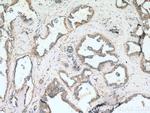 FBXL15 Antibody in Immunohistochemistry (Paraffin) (IHC (P))