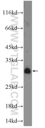 FBXL15 Antibody in Western Blot (WB)