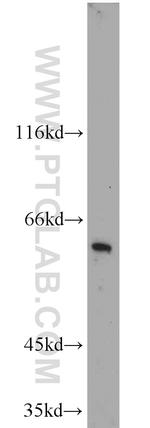 SLC47A1 Antibody in Western Blot (WB)