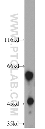 SLC47A1 Antibody in Western Blot (WB)