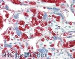 Red Blood Cell Polyclonal Antibody