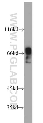 ZNF496 Antibody in Western Blot (WB)