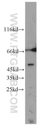 CCDC83 Antibody in Western Blot (WB)