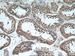 FAM71E2 Antibody in Immunohistochemistry (Paraffin) (IHC (P))