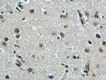 FAM71E2 Antibody in Immunohistochemistry (Paraffin) (IHC (P))