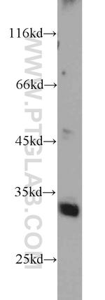 FAM71E2 Antibody in Western Blot (WB)