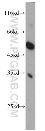 FAM71E2 Antibody in Western Blot (WB)