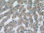 C3orf20 Antibody in Immunohistochemistry (Paraffin) (IHC (P))