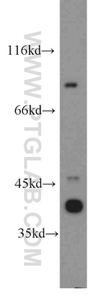 C3orf20 Antibody in Western Blot (WB)