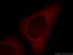 FGD5 Antibody in Immunocytochemistry (ICC/IF)