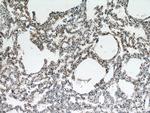FGD5 Antibody in Immunohistochemistry (Paraffin) (IHC (P))