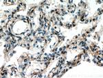 FGD5 Antibody in Immunohistochemistry (Paraffin) (IHC (P))