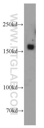 FGD5 Antibody in Western Blot (WB)