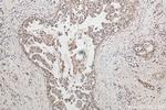 ITCH Antibody in Immunohistochemistry (Paraffin) (IHC (P))