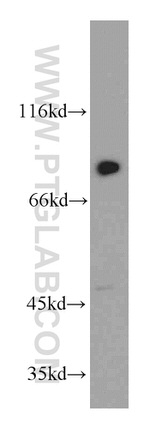 C7orf58 Antibody in Western Blot (WB)