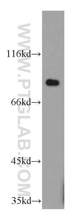 C7orf58 Antibody in Western Blot (WB)