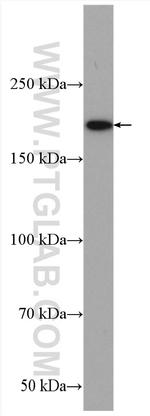 PHIP Antibody in Western Blot (WB)