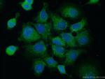 ACBD4 Antibody in Immunocytochemistry (ICC/IF)