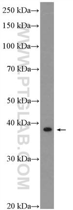 SAP30BP Antibody in Western Blot (WB)