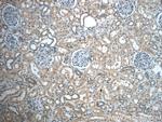 ZC3HAV1L Antibody in Immunohistochemistry (Paraffin) (IHC (P))