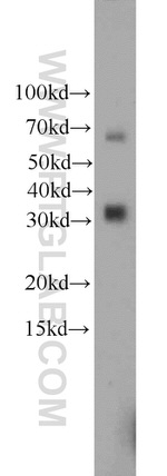 ZC3HAV1L Antibody in Western Blot (WB)